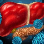 High liver enzymes