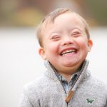 What is down syndrome?