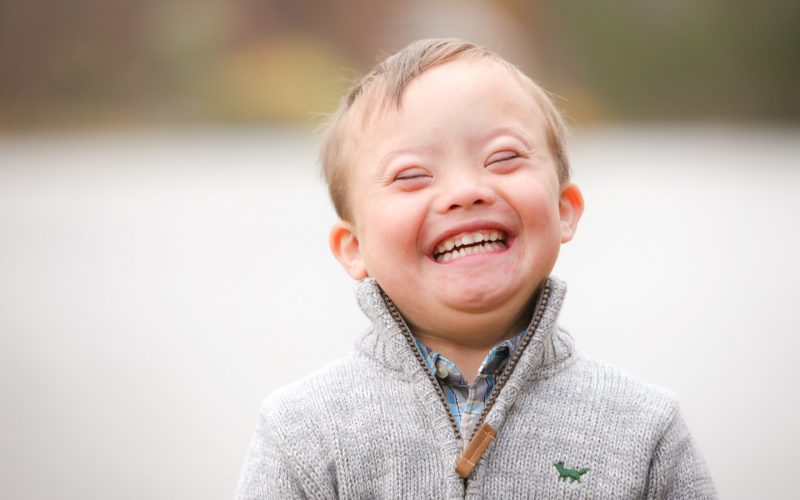 What is down syndrome?