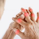 What is gout?