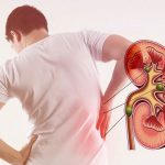 What is kidney failure?