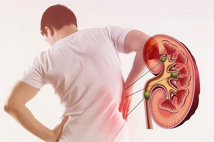 What is kidney failure?