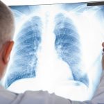 What is pulmonary tuberculosis?